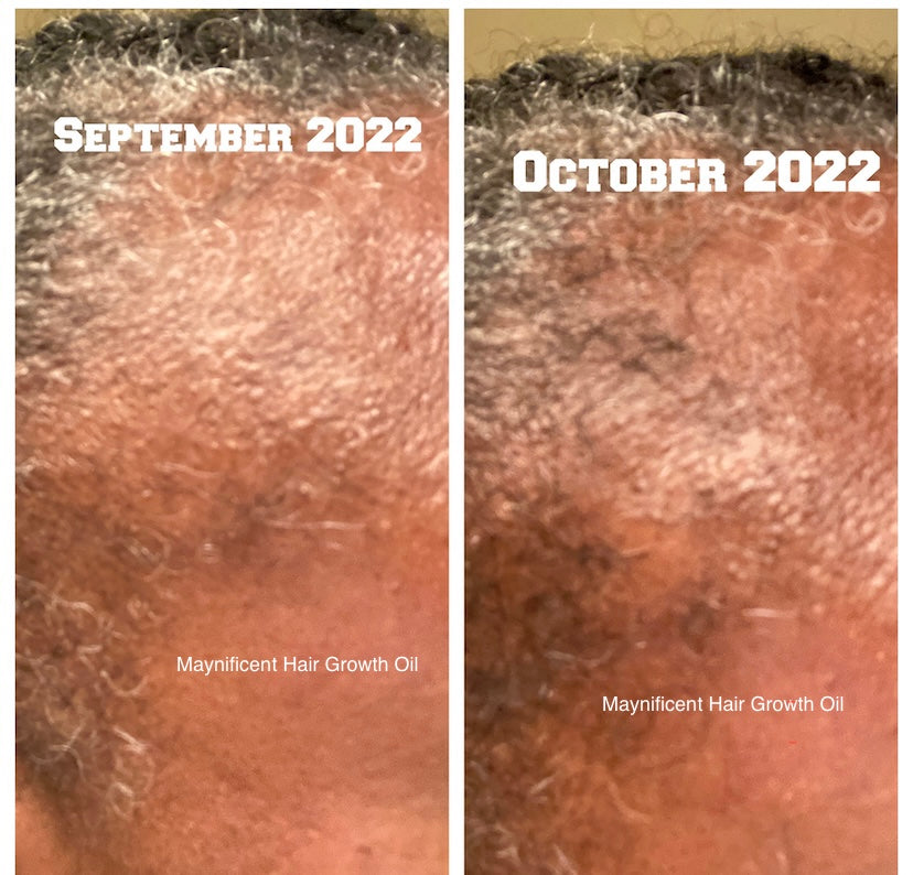 Hair Growth Oil 